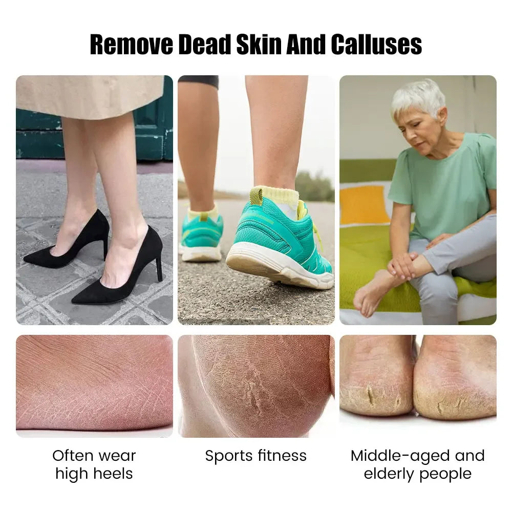 Wireless Electric Foot Grinder