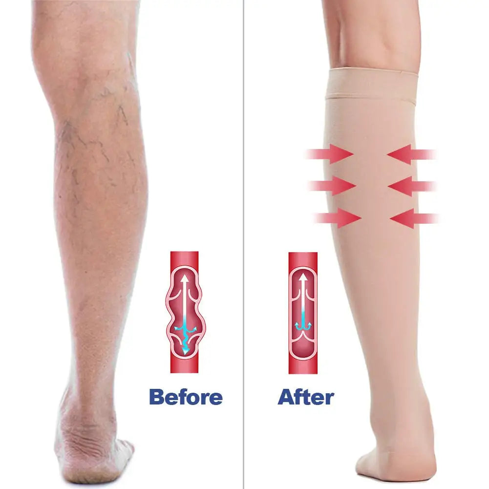 Open Toe Knee High Calf Compression Socks Women & Men - MONLANE