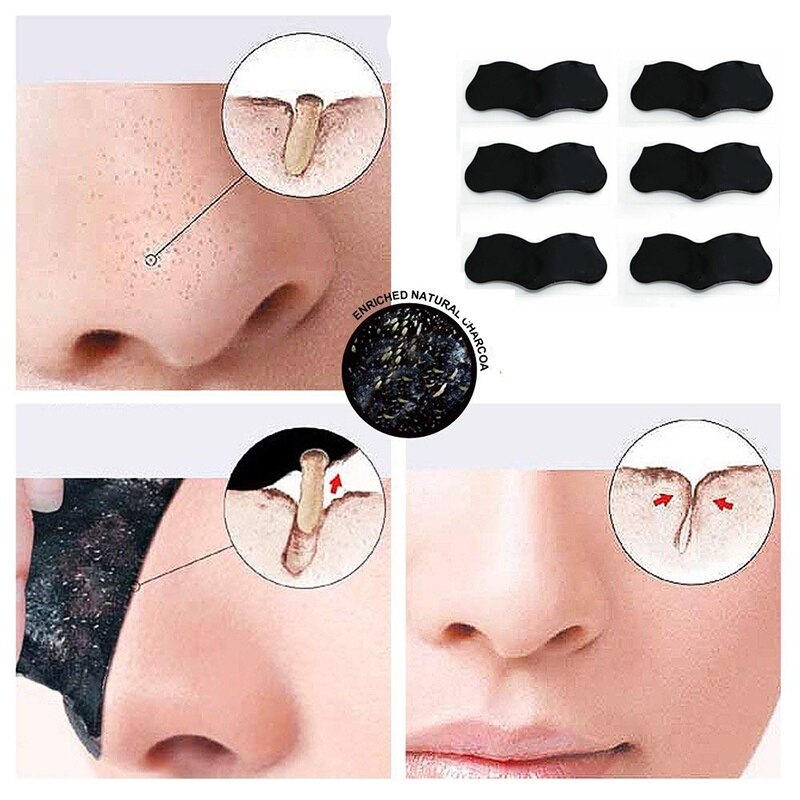 Blackhead Remover - MONLANE