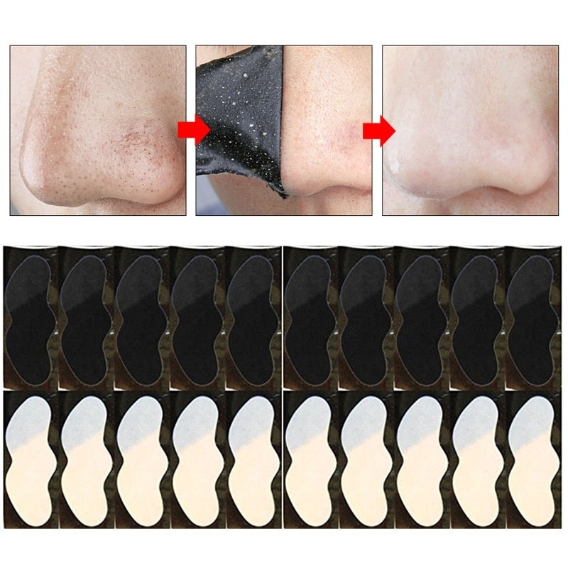 Blackhead Remover - MONLANE