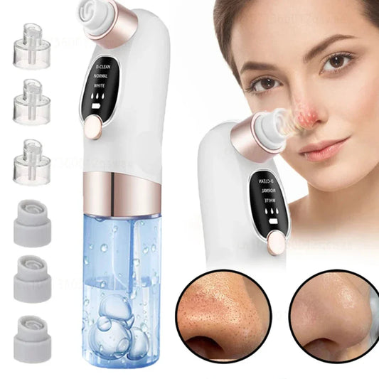 Deep Cleaning  Black Head Remover VIDEO