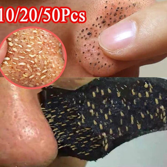 Blackhead Remover - MONLANE