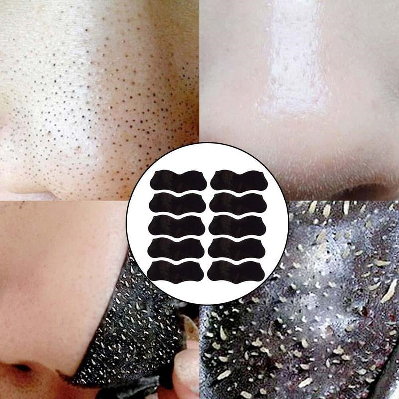 Blackhead Remover - MONLANE